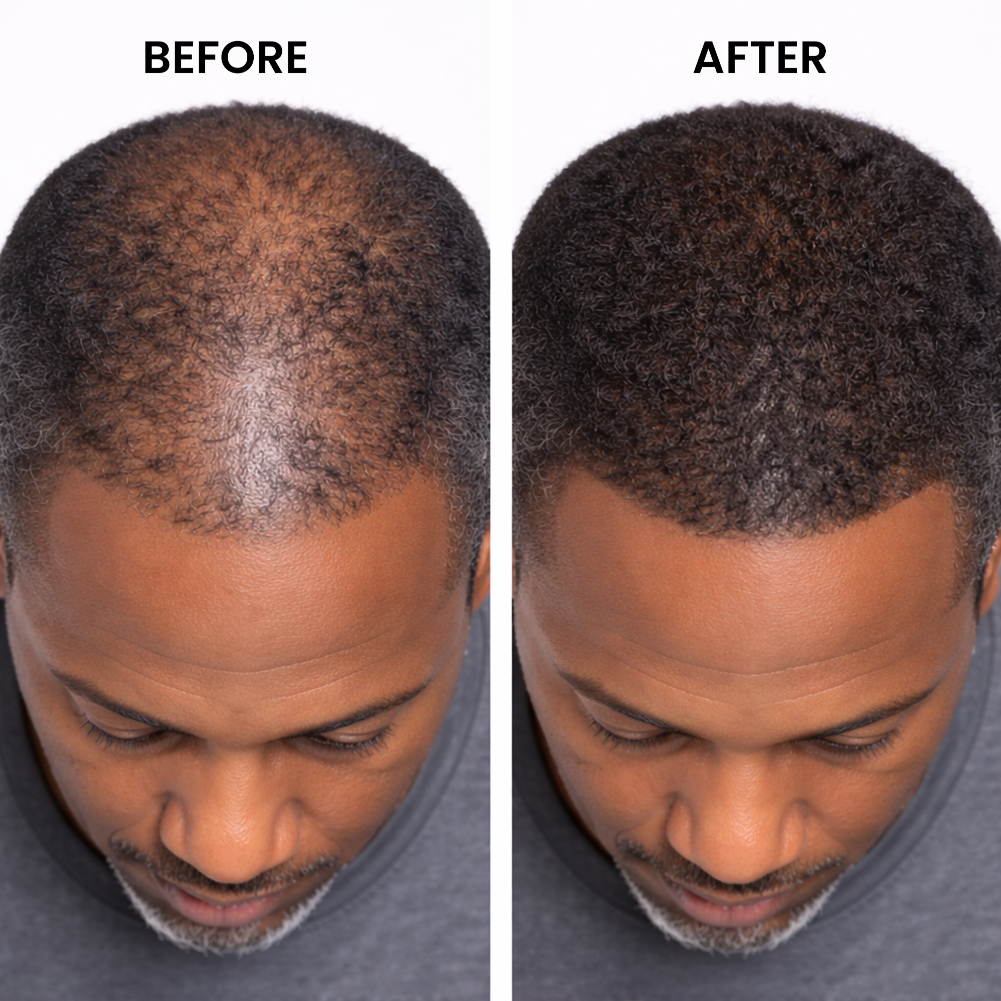 A before-and-after image of a man's hair, which appears thicker and fuller in the after photo.