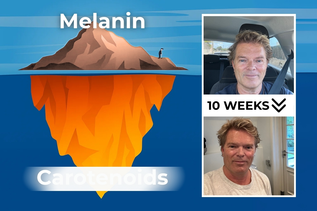 An iceberg diagram of Melanin and Carotenoids next to before and after photos of a man.