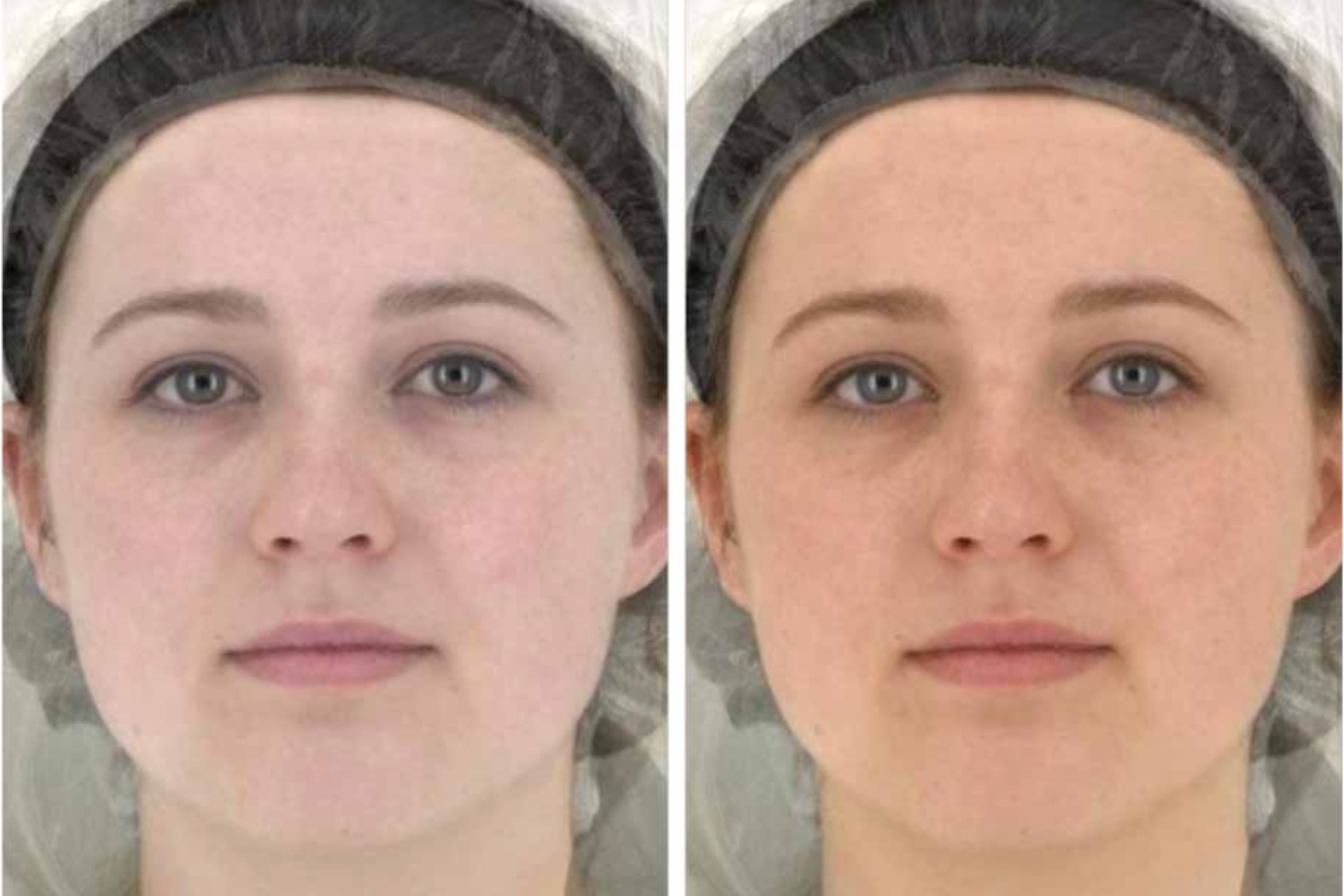 A side-by-side comparison of a woman's face, showing a difference in skin complexion between the two images.