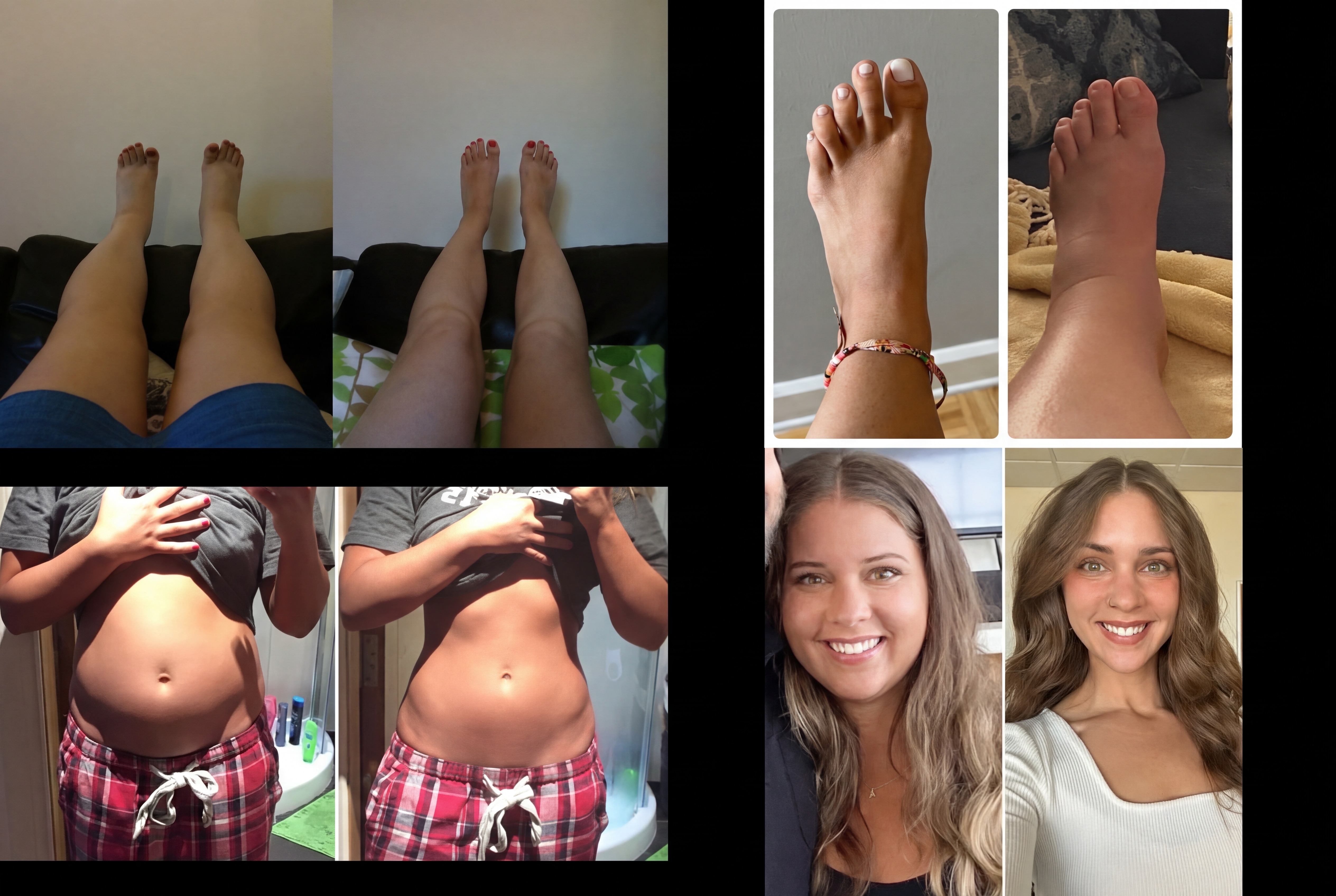 Collage of legs, feet, torsos, and two women smiling.