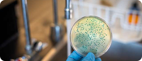 Gloved hand holding a petri dish with green bacterial colonies.