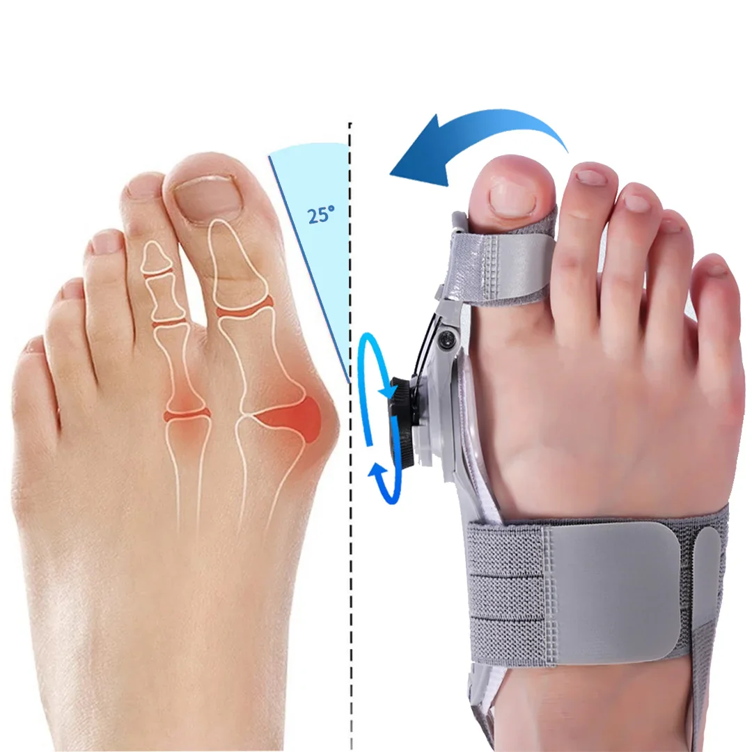 Bunion Fix – Treatmedy