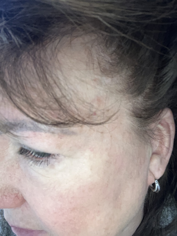 A close-up of the side of a person's face showing their hair, forehead, closed eye, and an earring.