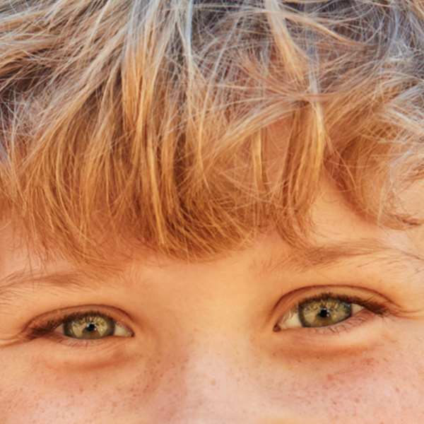 Close-up of a child's eyes and hair, with a smiling expression.