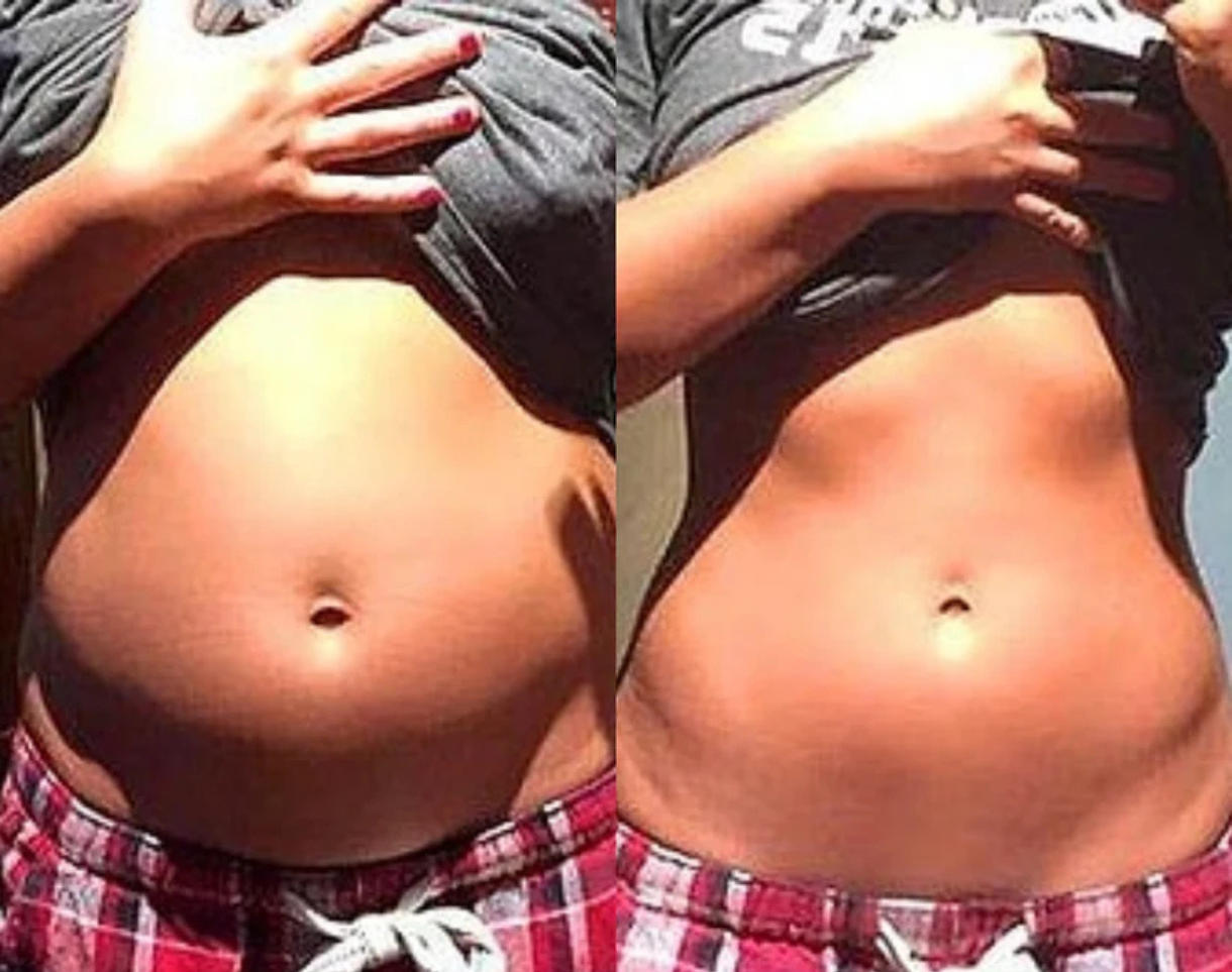 Side-by-side comparison of a person's midsection with slight differences.