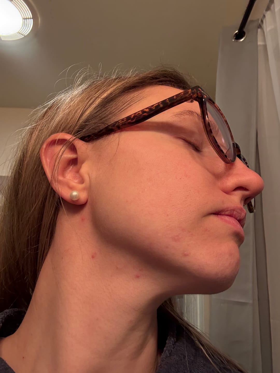 Profile of a person with glasses and a pearl earring, showing blemishes on the face and neck.