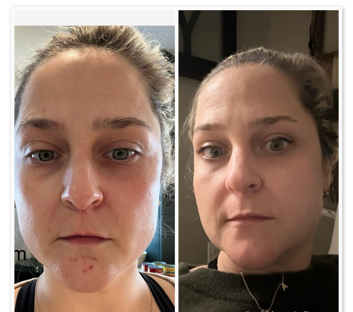 A side-by-side comparison of two close-up photos of a woman's face.