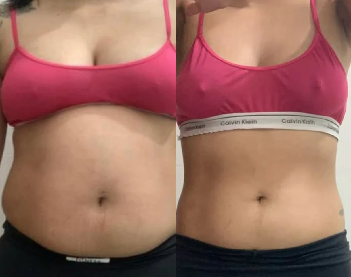 Side-by-side images showing a person's midsection before and after changes.