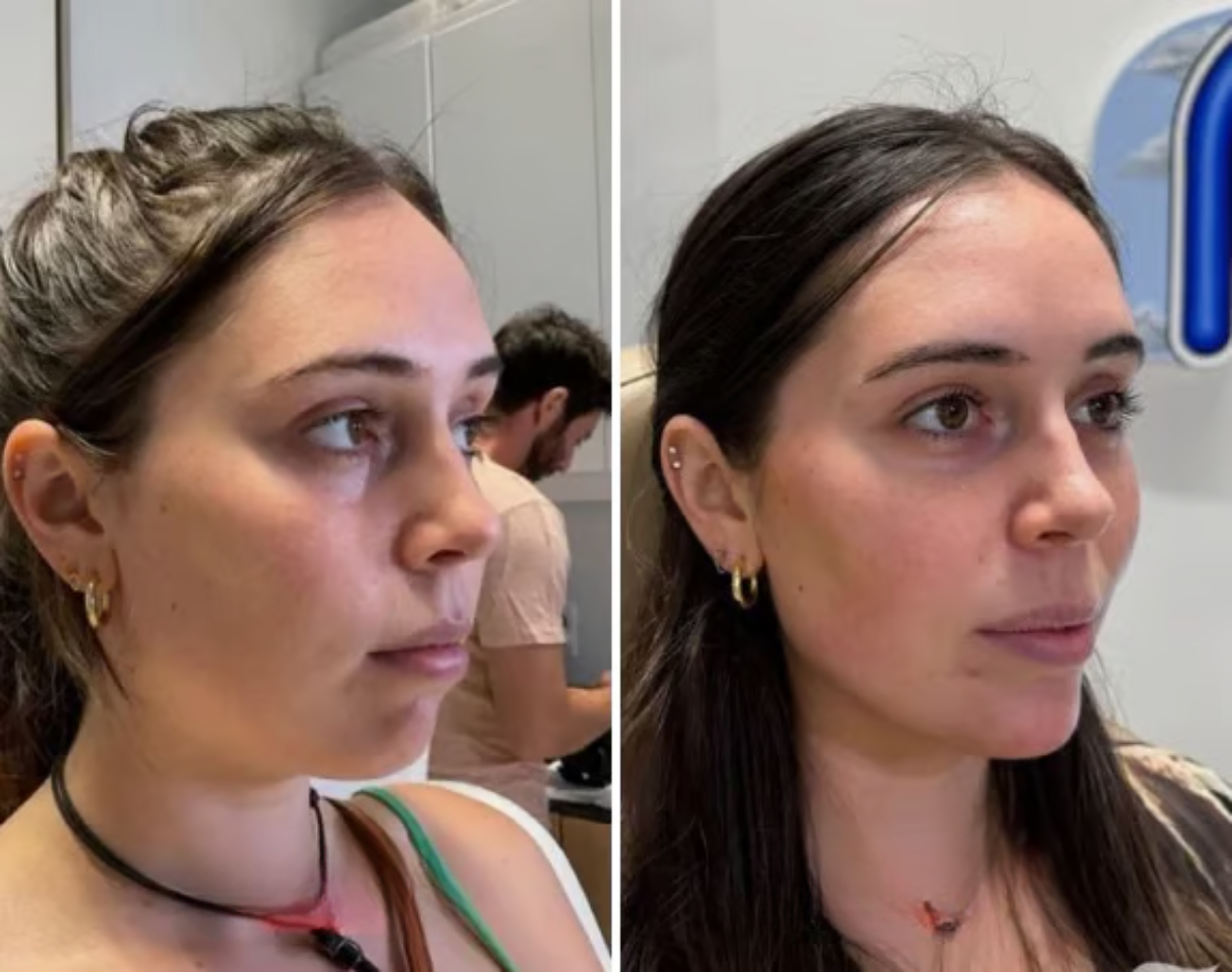 Two side-by-side photos of a woman looking in different directions.