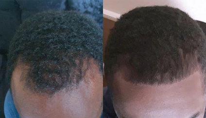 Side-by-side comparison of hair before and after treatment.