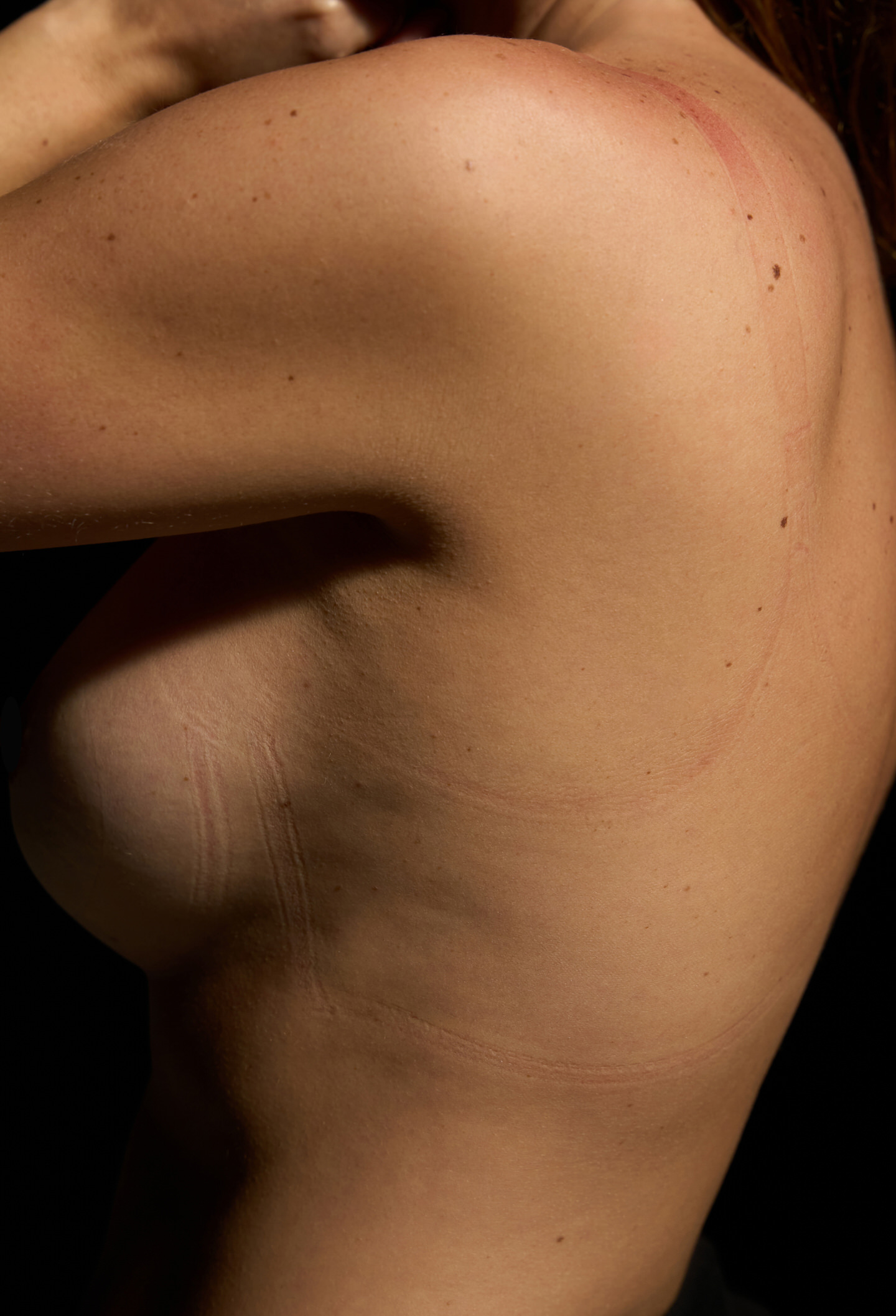 Close-up of a person's shoulder and upper arm with visible skin texture.