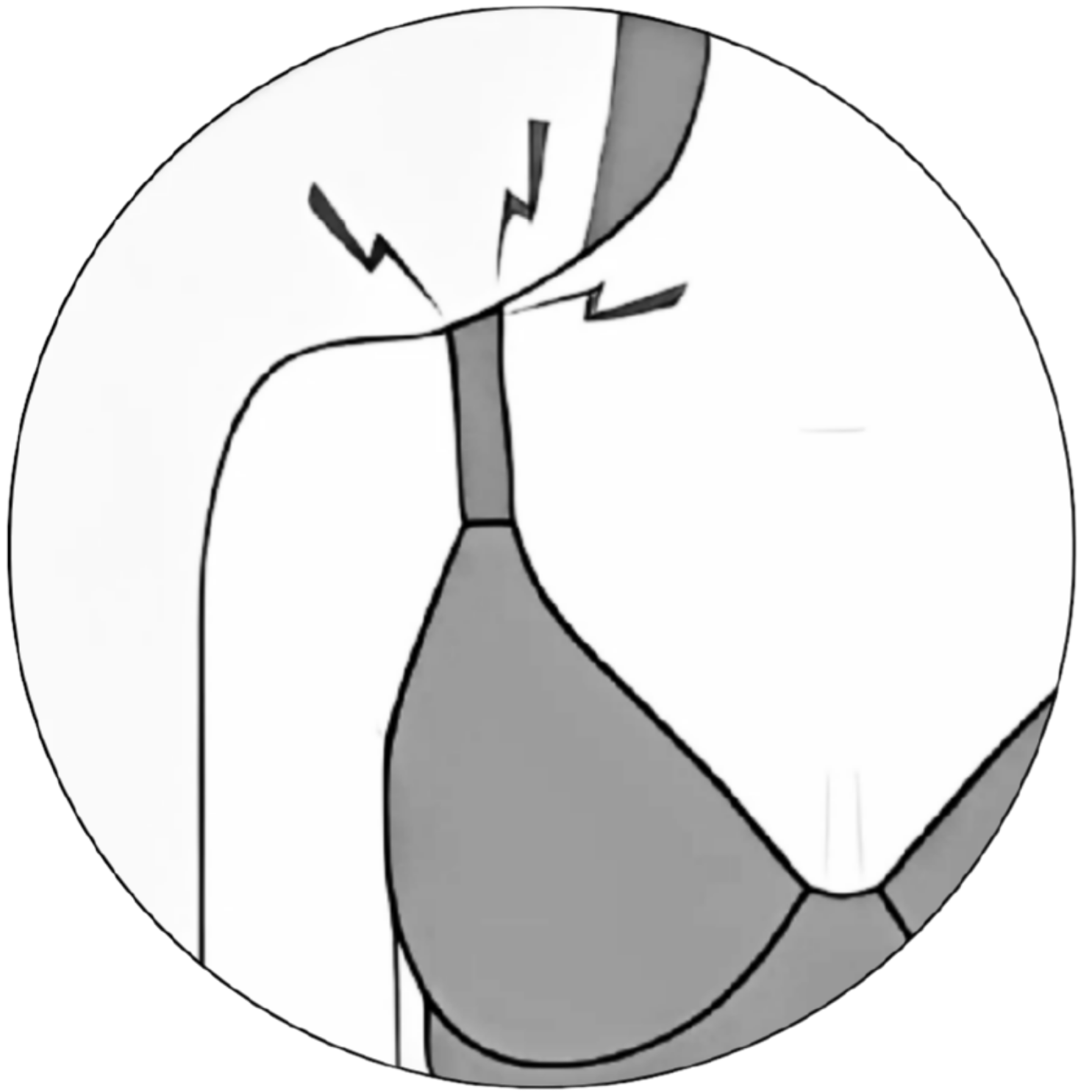 Illustration of a person wearing a bra with pain lines on the shoulder.