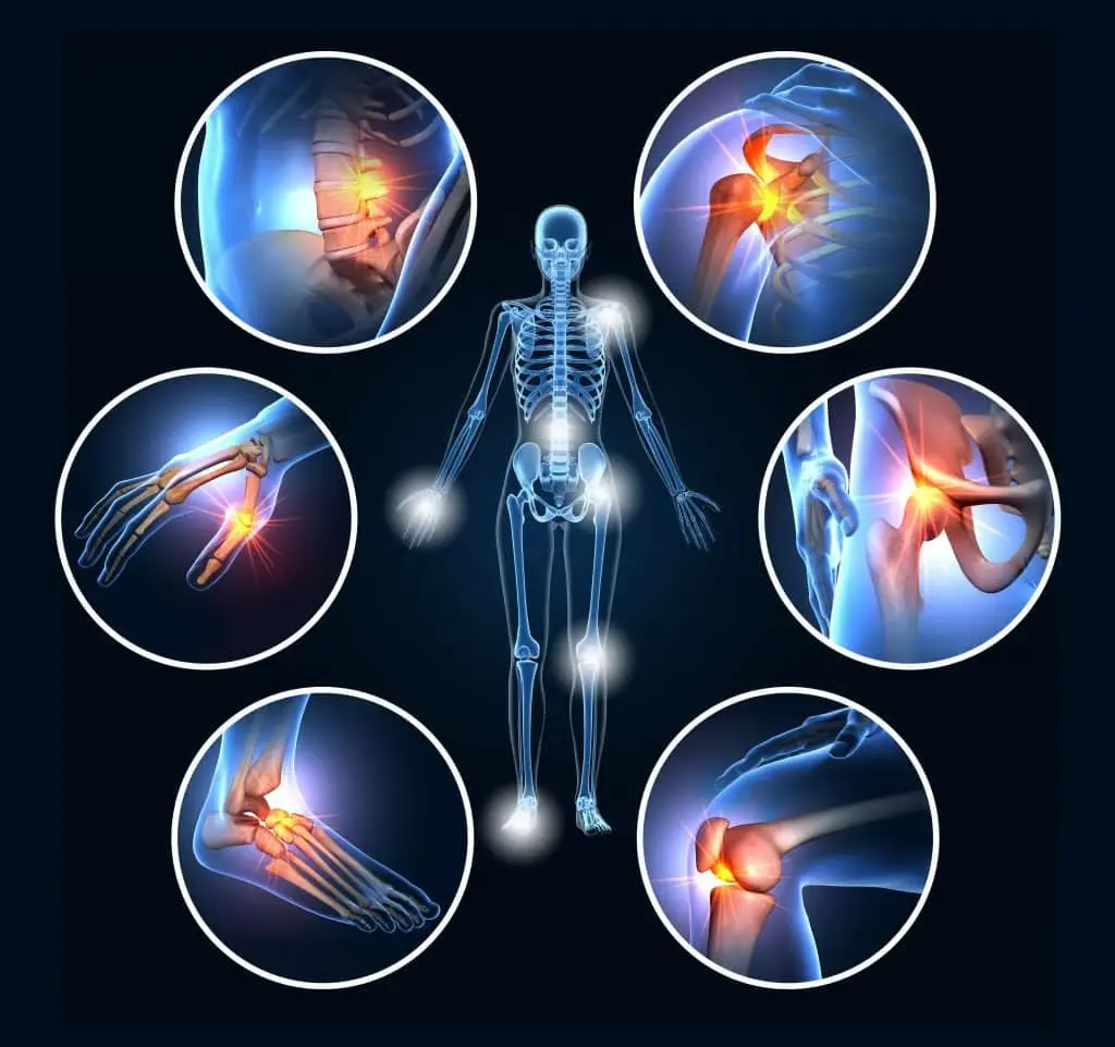 Illustration of human skeleton with highlighted joint pain areas in circular insets.
