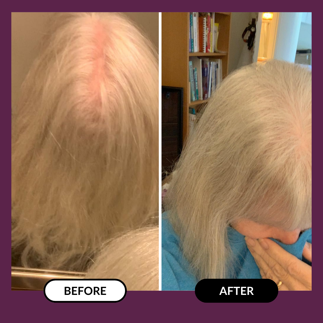 Side-by-side comparison of hair before and after treatment.