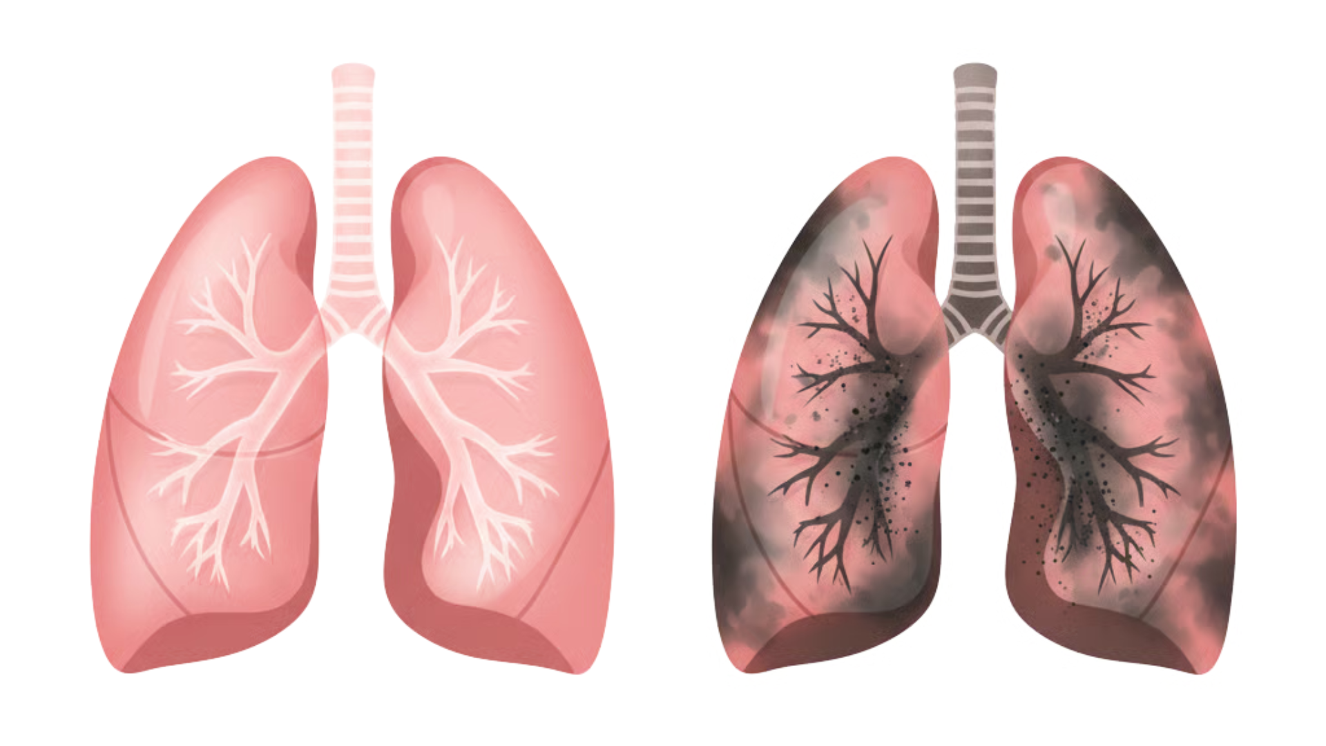 Illustration comparing healthy and unhealthy lungs side by side.