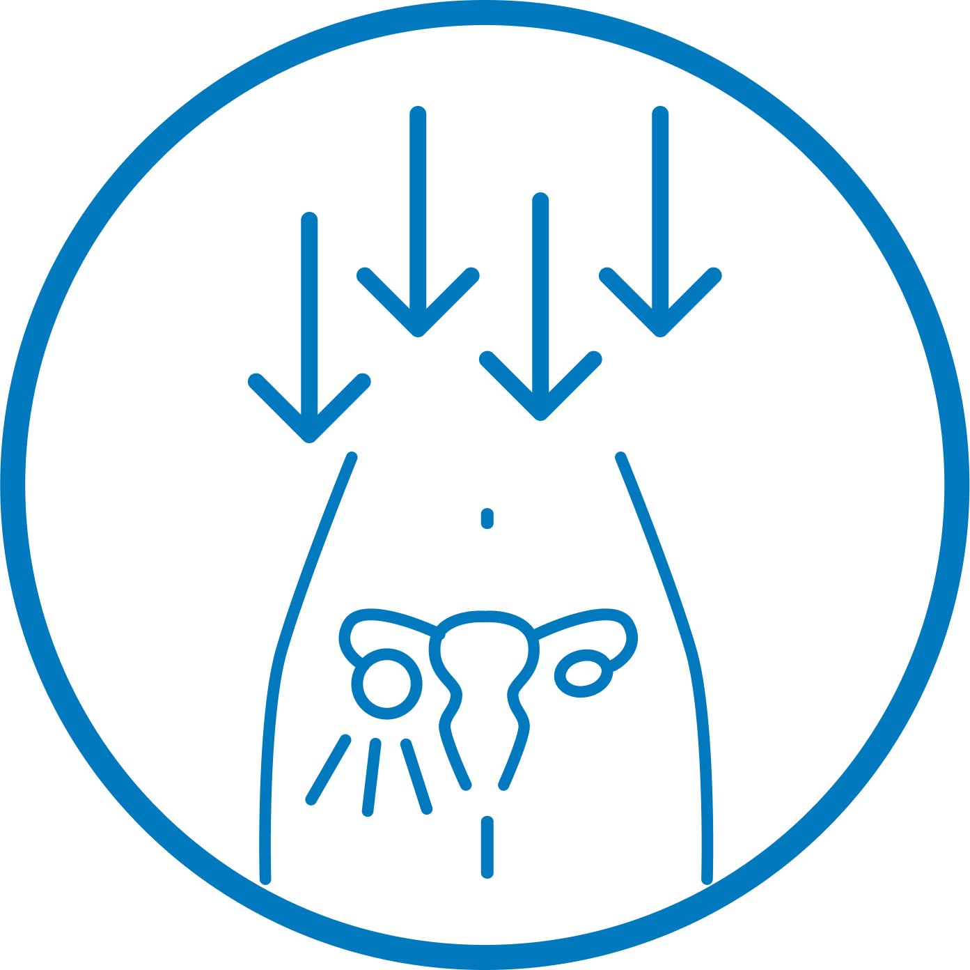 Blue line drawing of a uterus with downward arrows.