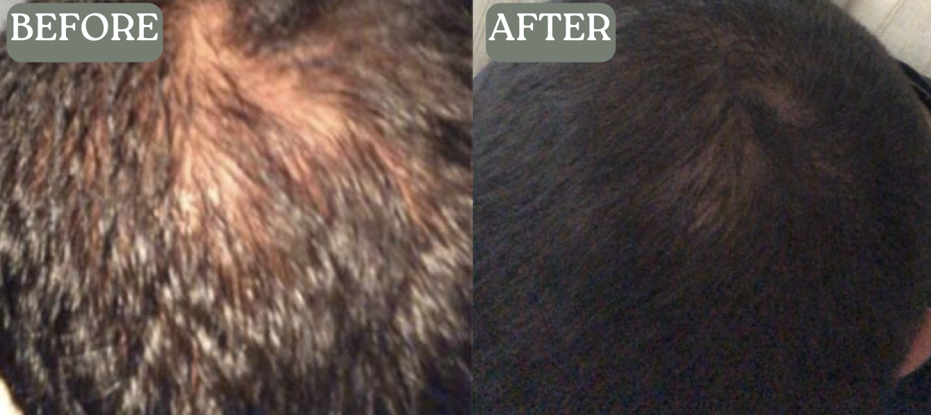 Side-by-side comparison of hair before and after treatment.
