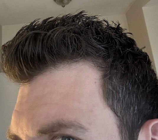 Close-up of a person's side profile with short, styled dark hair.
