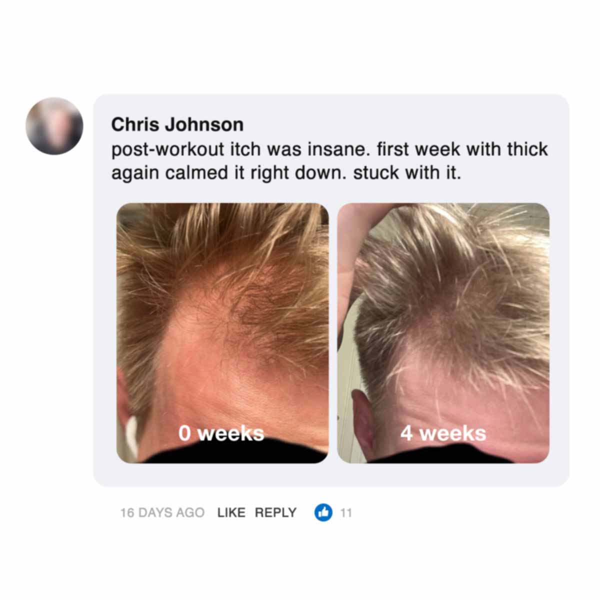 Side-by-side photos of a person's hairline at 0 and 4 weeks.