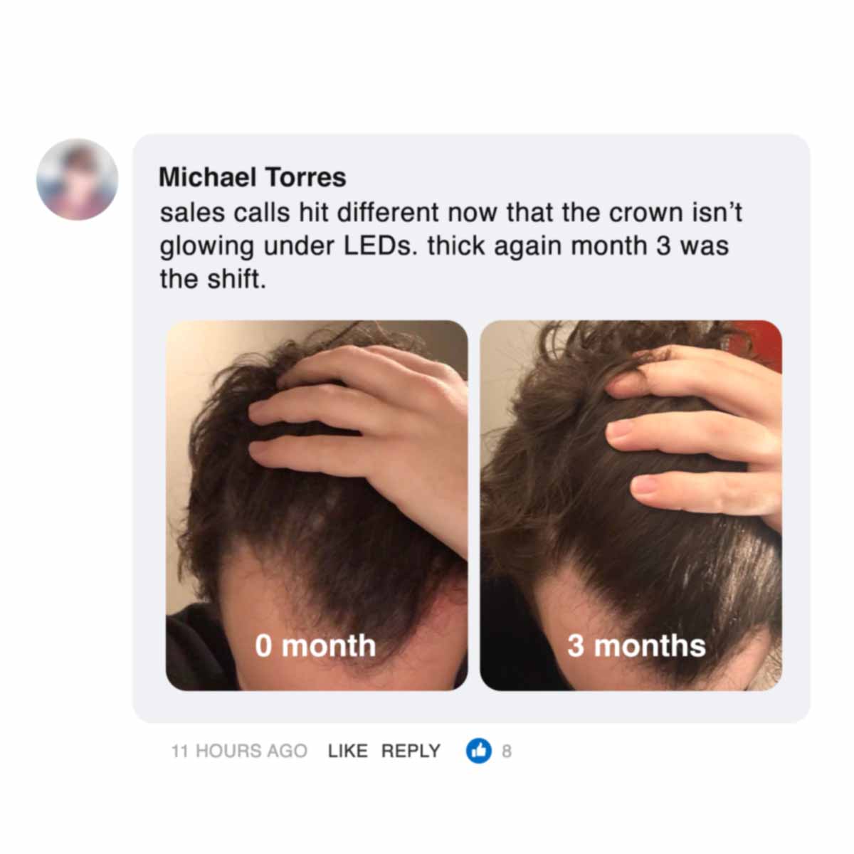 Before and after hair growth comparison over three months.