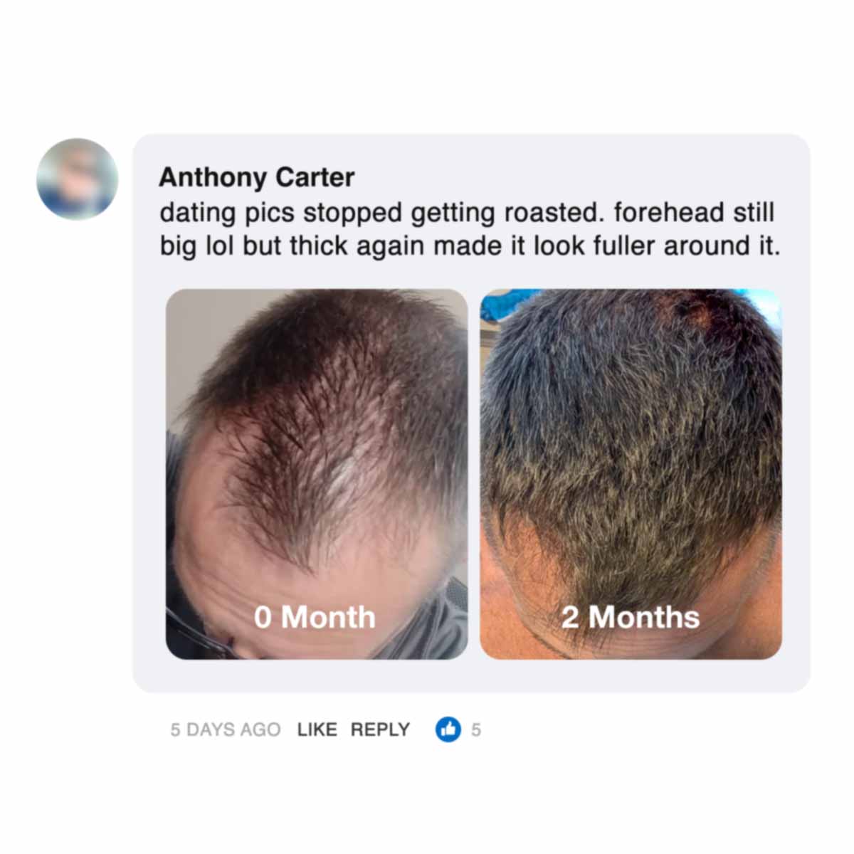 Comparison of hair growth over two months.
