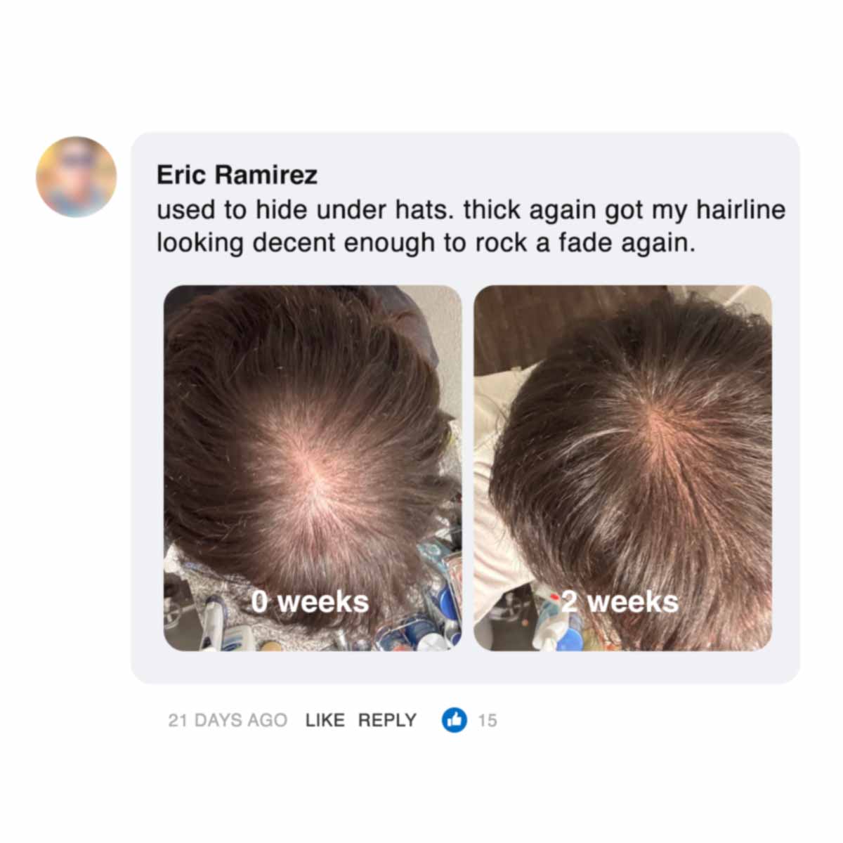 Two side-by-side photos of hair regrowth over two weeks.