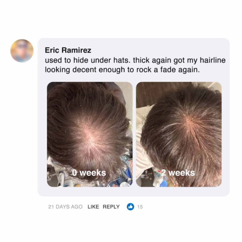 Two side-by-side photos of hair regrowth over two weeks.