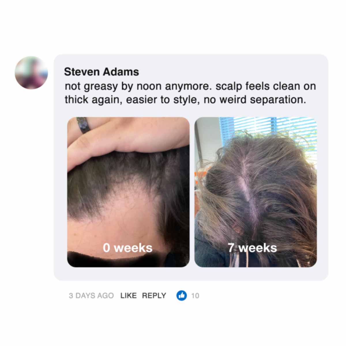 Comparison of scalp at 0 weeks and 7 weeks with text feedback above.