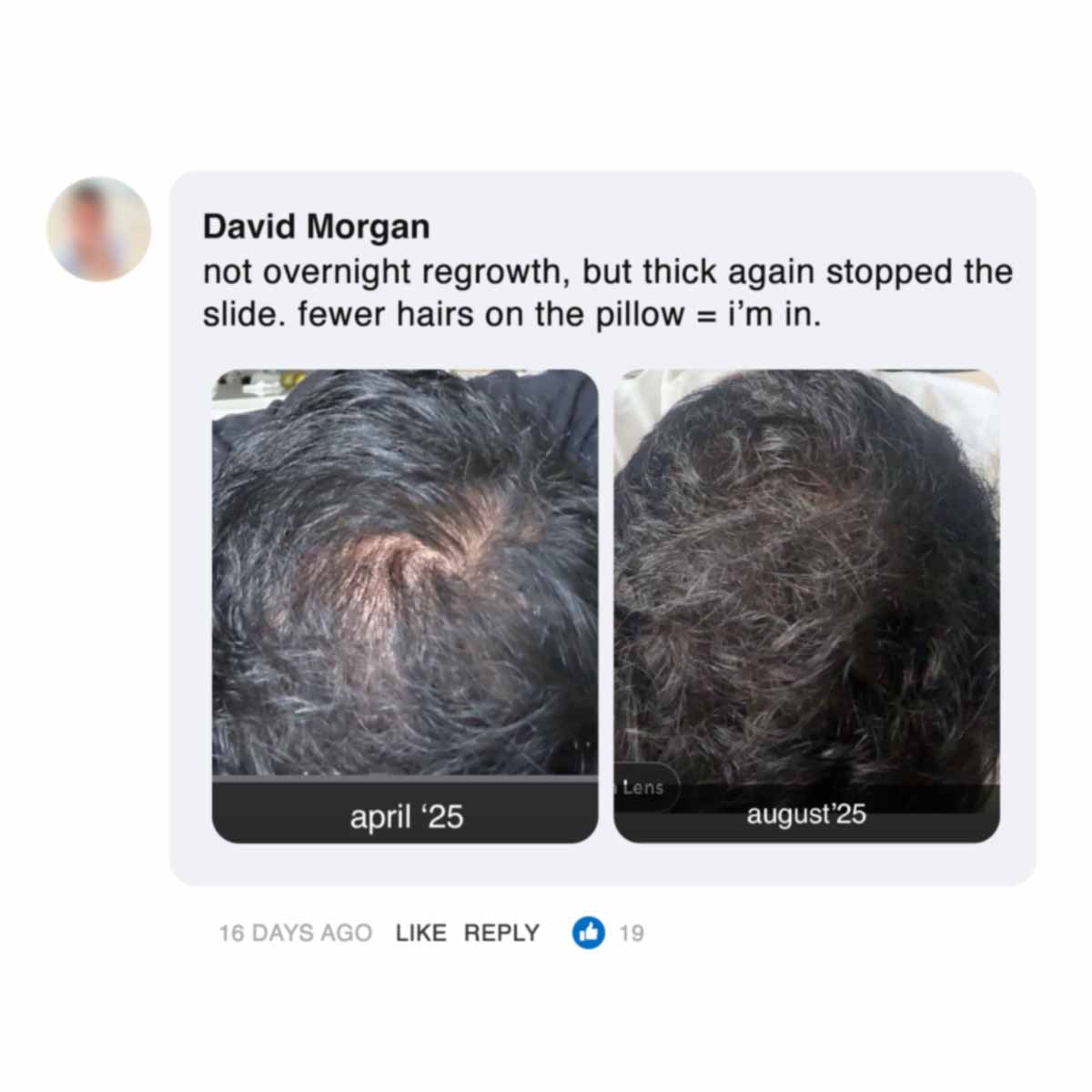 Two images of hair before and after regrowth over time.