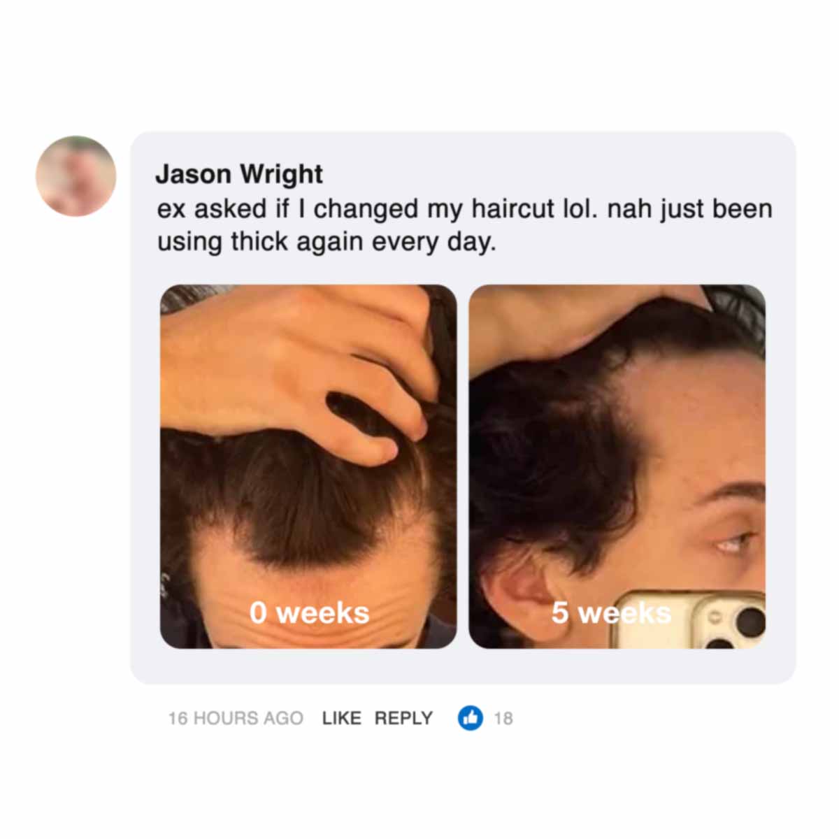 Before and after photos of hair growth over five weeks with a comment above.