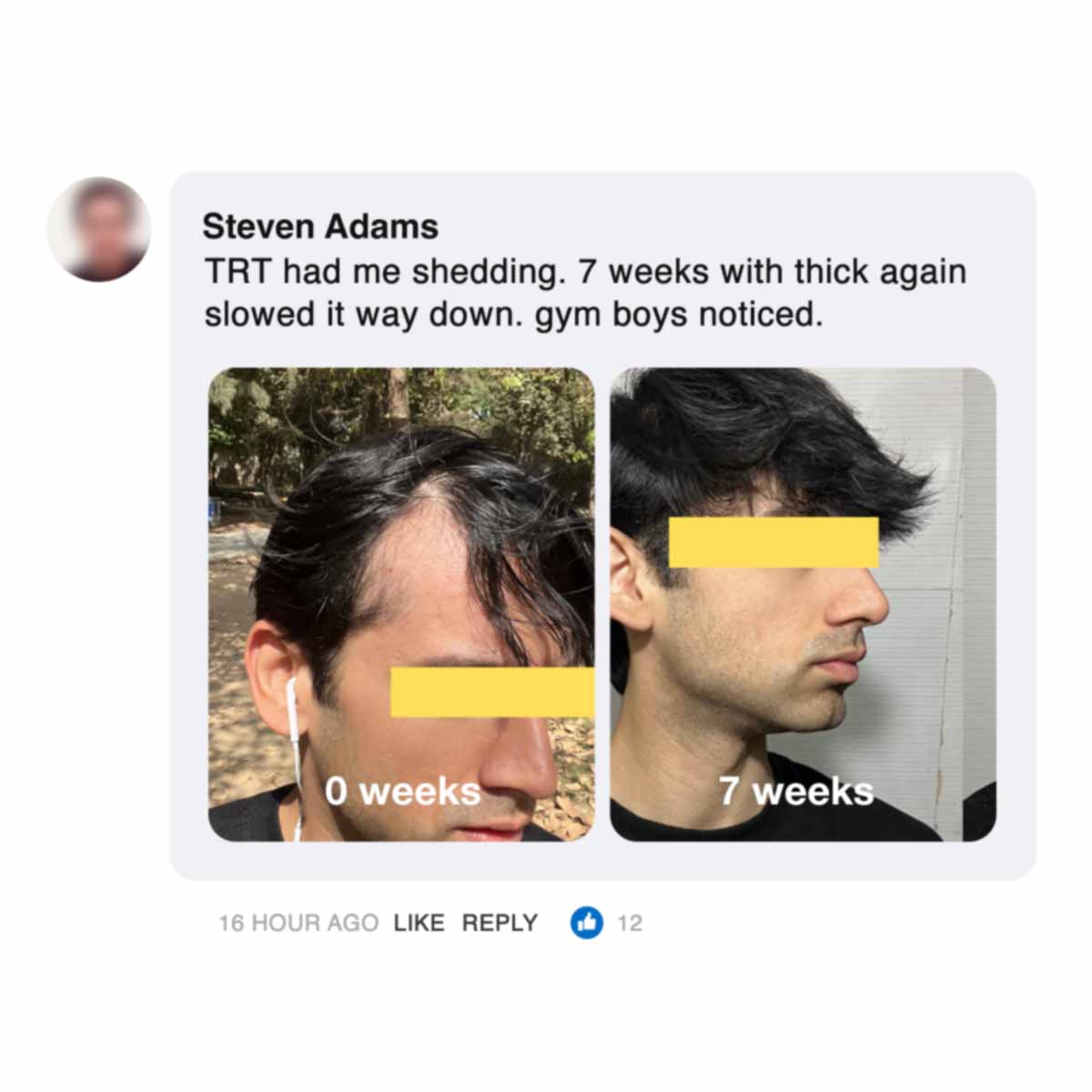 Side-by-side hair growth comparison over seven weeks, faces partially obscured.