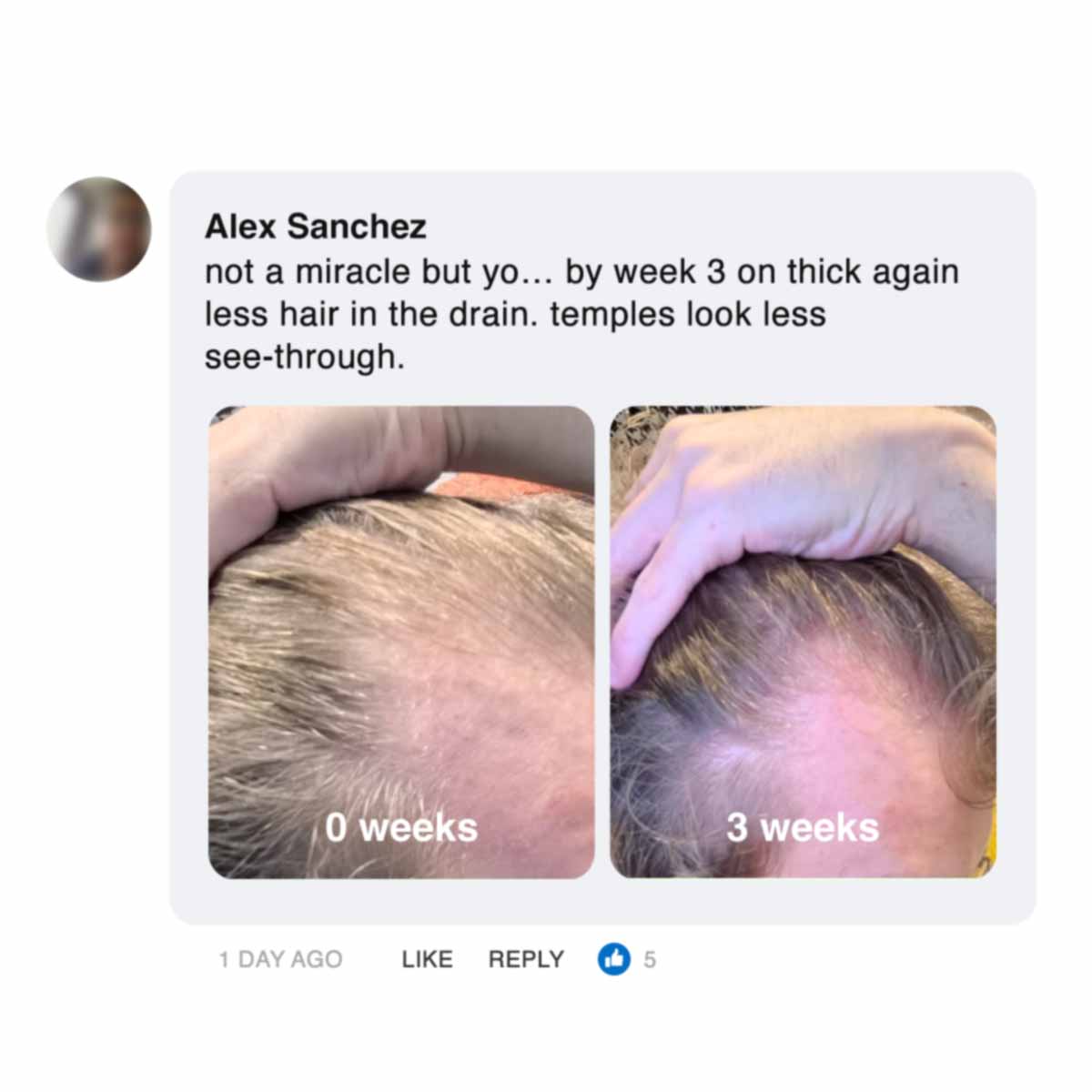 Comparison of hair growth at 0 weeks and 3 weeks.