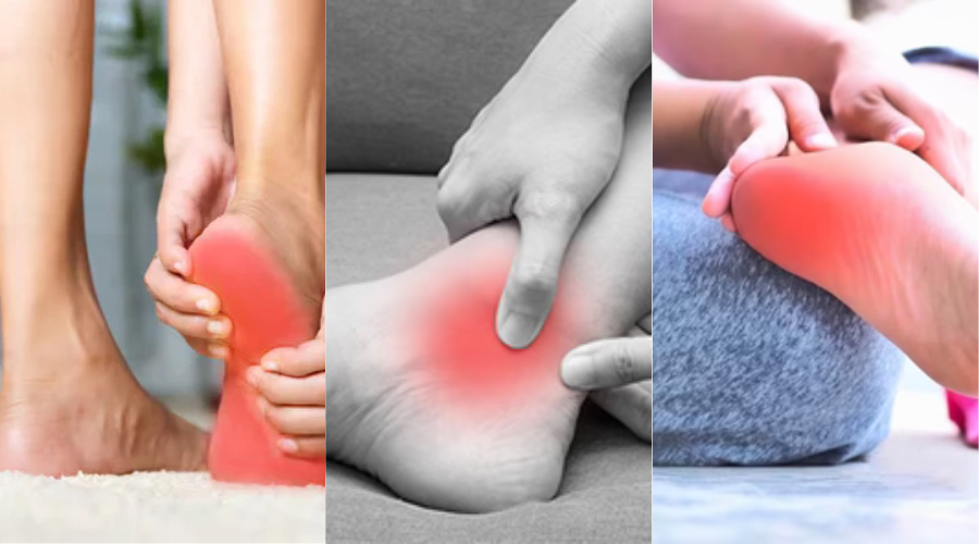 Three images of feet with red areas indicating pain or discomfort.