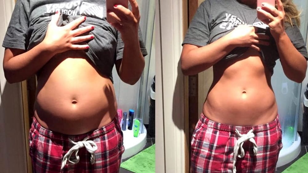A side-by-side comparison of a person's midsection, showing a bloated stomach on the left and a flatter stomach on the right.