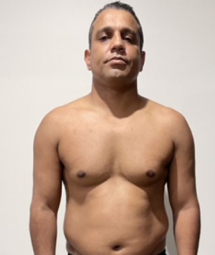 A person standing shirtless against a plain background.
