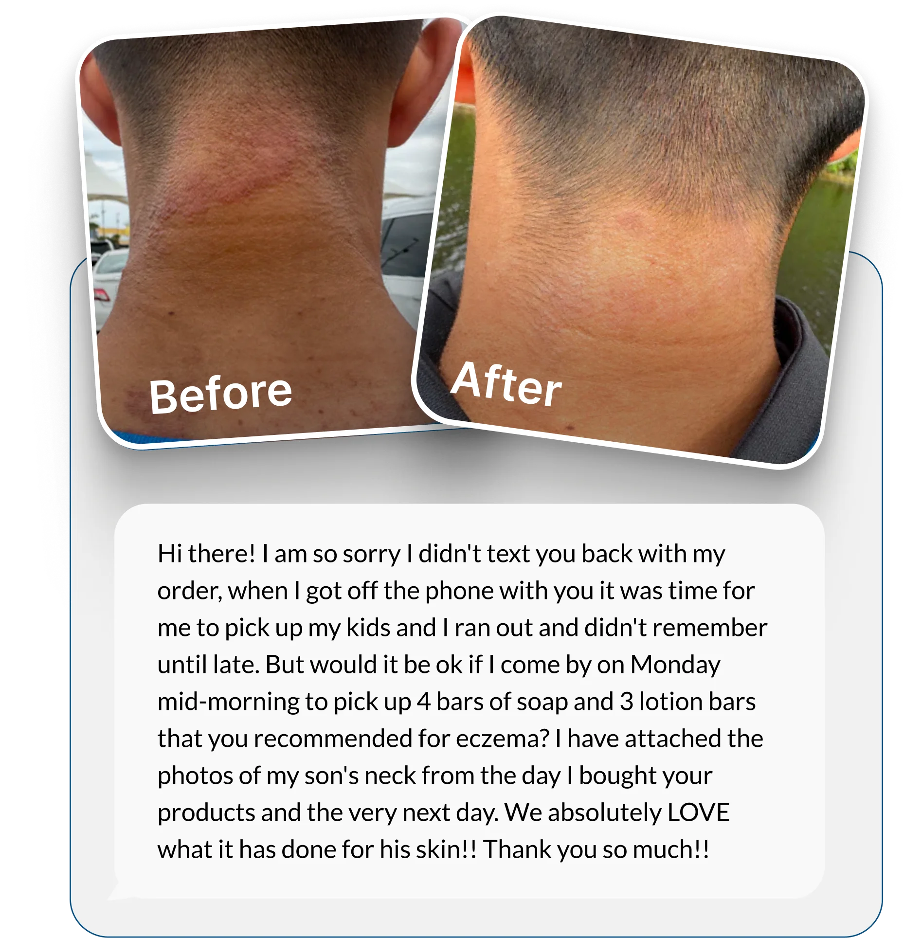 A before and after image showing the improvement of a rash on the back of a neck.