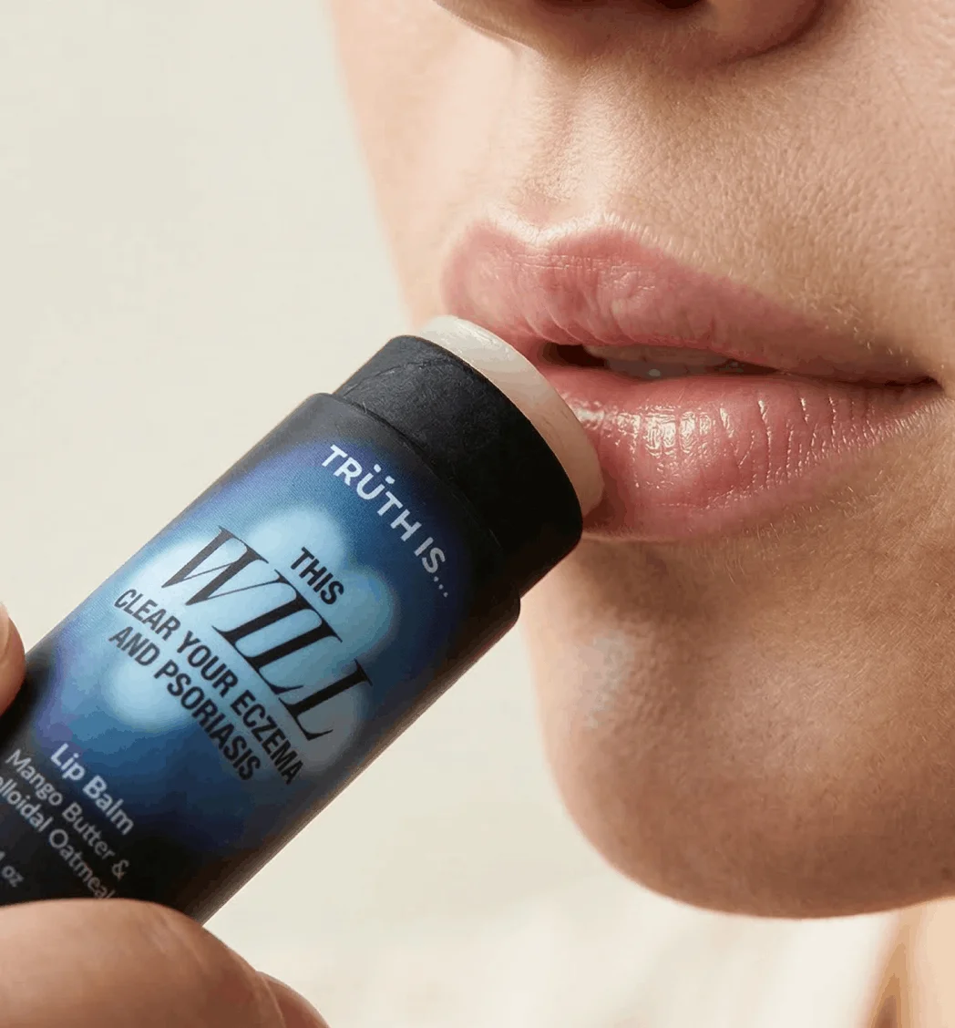 A close-up of a person applying This Will Clear Your Eczema and Psoriasis lip balm.