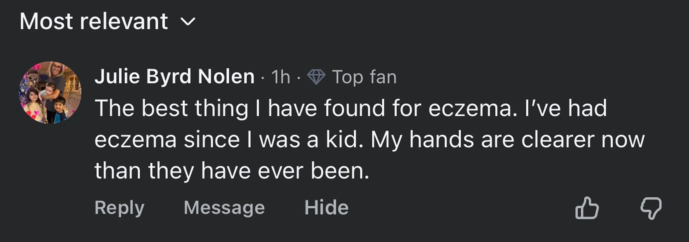 A screenshot of a social media comment by Julie Byrd Nolen about finding relief for her eczema.