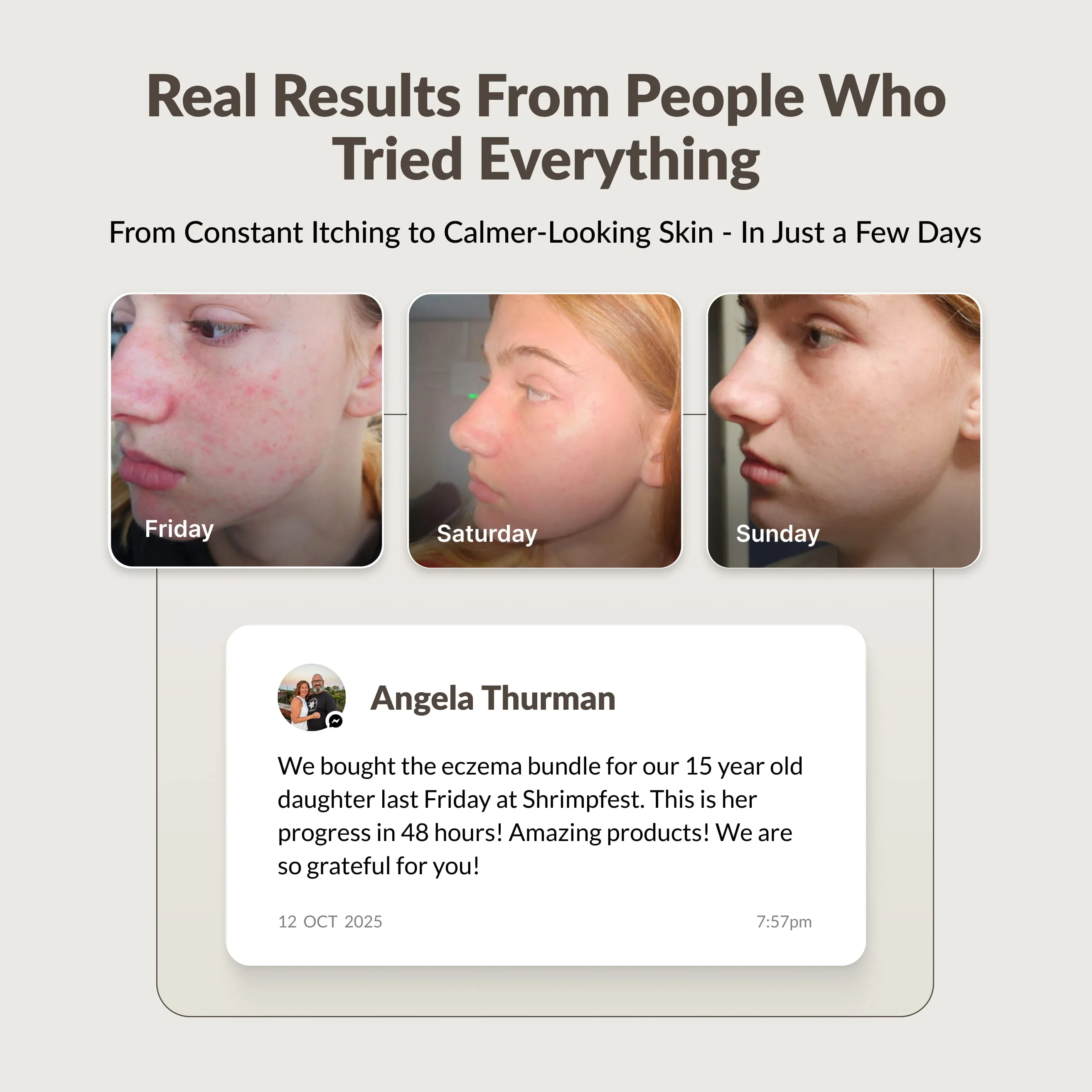 Before-and-after photos of a young woman's skin improving over three days, shown with a positive customer testimonial.
