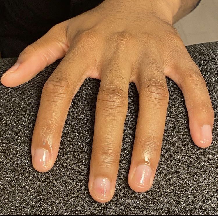 A hand resting on a textured black surface.