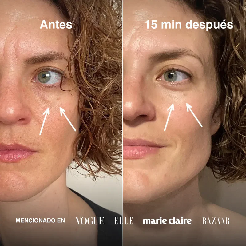 Before and after comparison of a woman's face with text in Spanish.