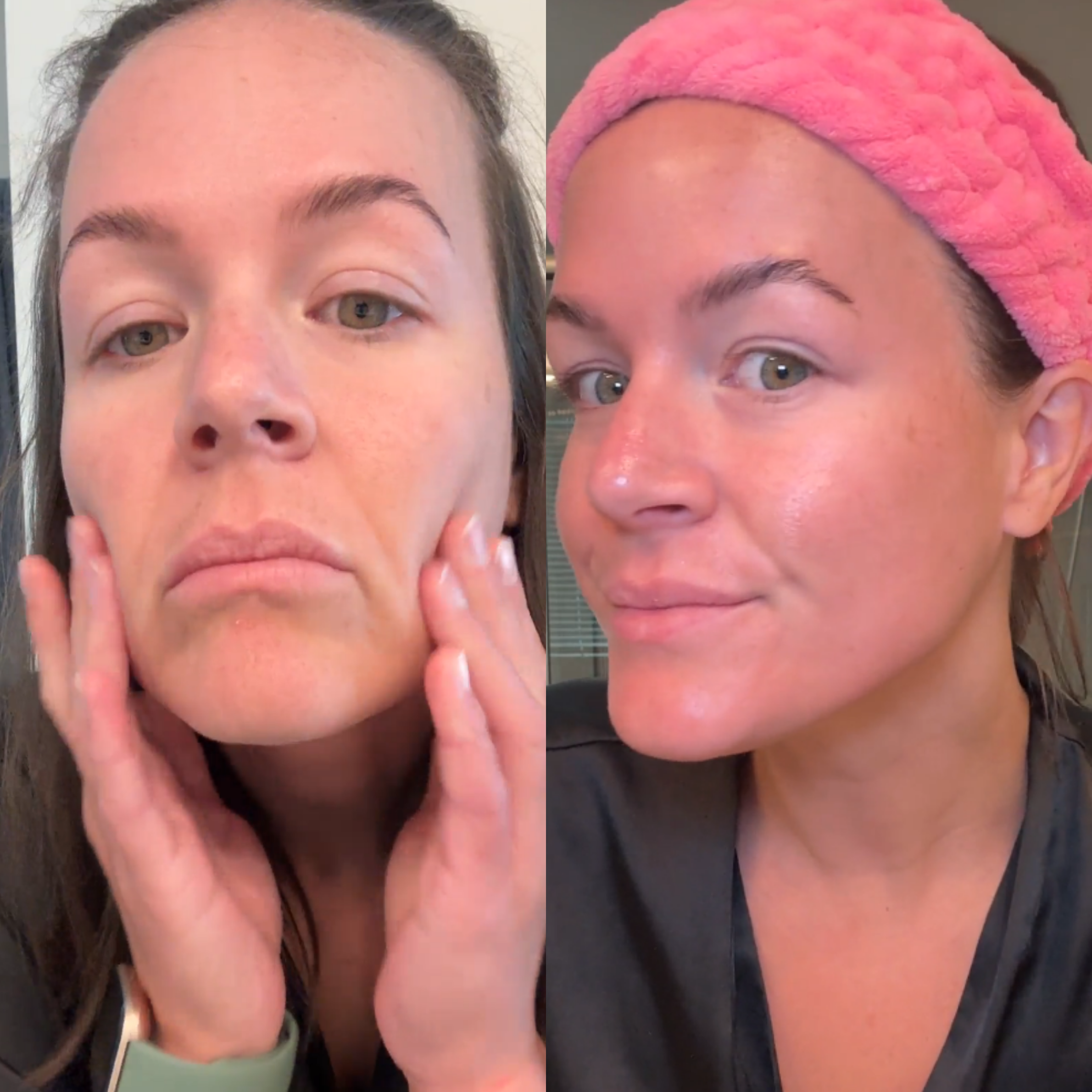 Two side-by-side images of a woman, one touching her face and one wearing a pink headband.