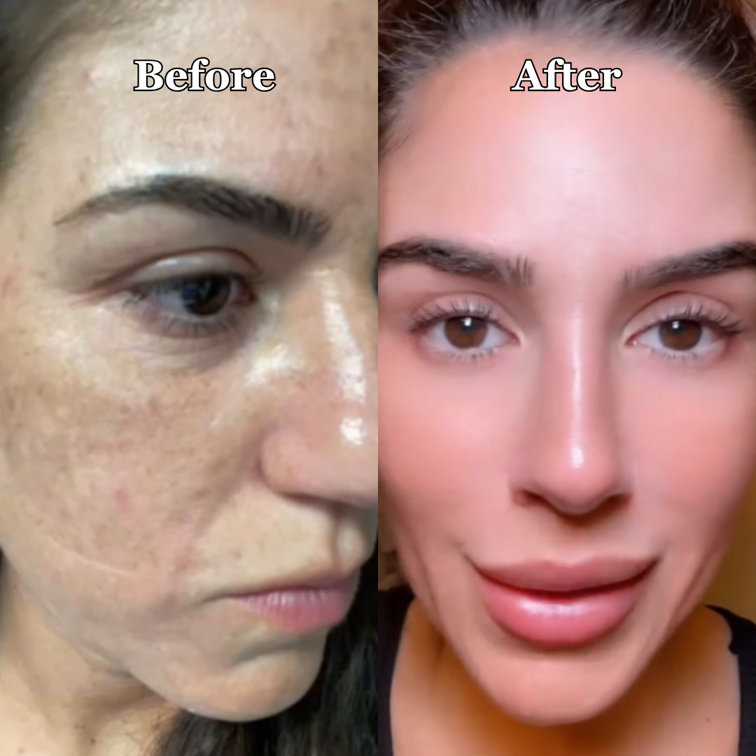 Side-by-side comparison of a woman's face labeled 'Before' and 'After'.