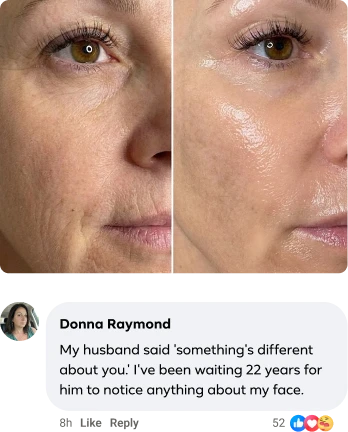 A before and after image of a woman's face with a testimonial from Donna Raymond below it.