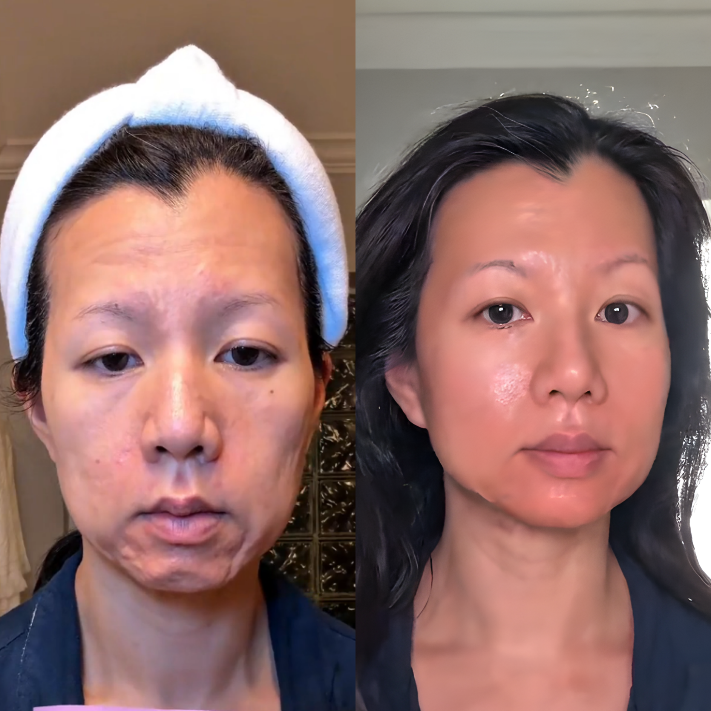 Two images show a woman's face before and after skincare treatment.