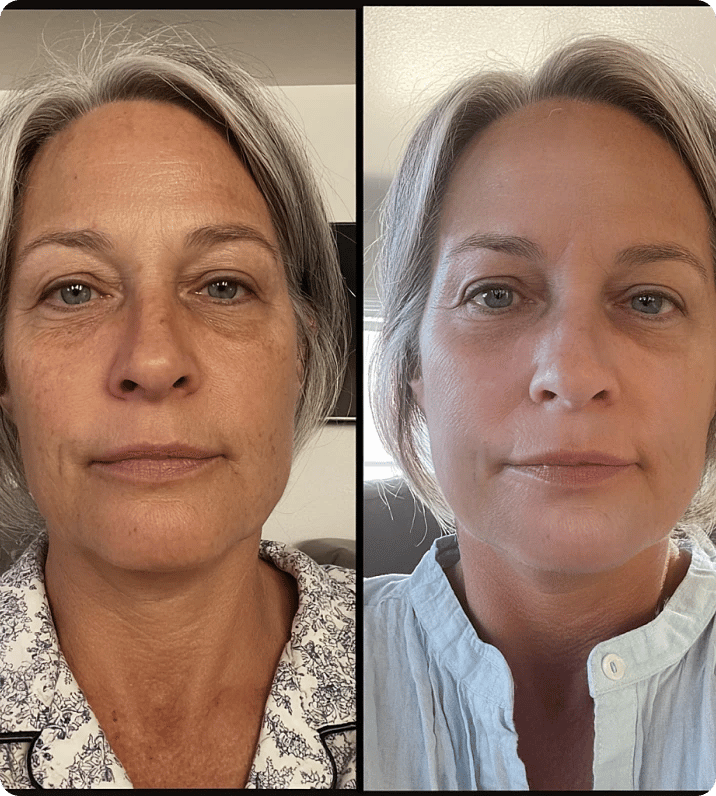 Side-by-side comparison of two images of a woman