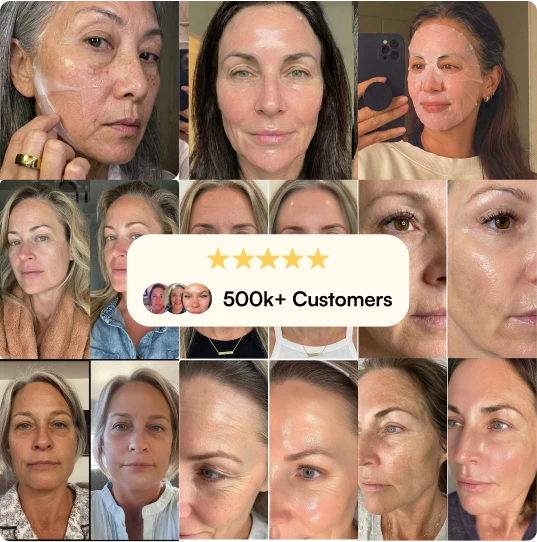 A collage of before-and-after photos of women's faces, with a '500k+ Customers' and five-star rating banner.