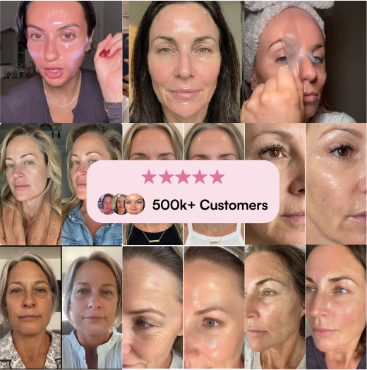 A collage of women's faces showing before and after results from a skincare product, with a 5-star rating.