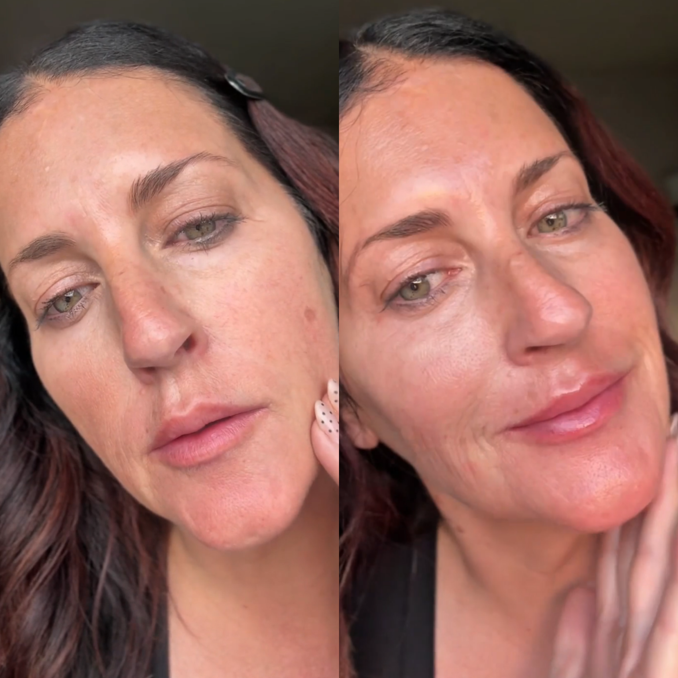 Two close-up photos of a woman's face showing skin texture.