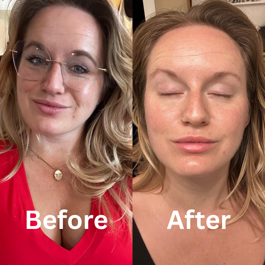 Side-by-side comparison of a person before and after using skincare treatment.